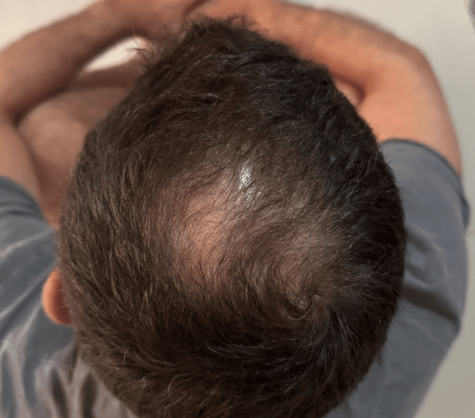 After treatment
