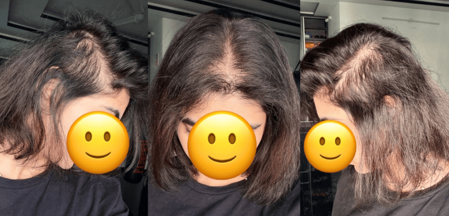Before treatment